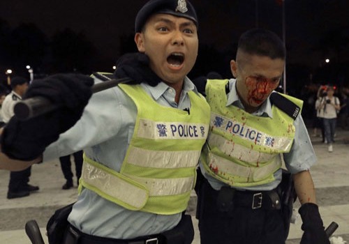 Honkonqda keçirilən qanunsuz aksiyalarda 179 polis əməkdaşı xəsarət alıb