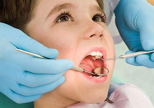 Süd dişlərində çürük yaranmasının əsas səbəbləri