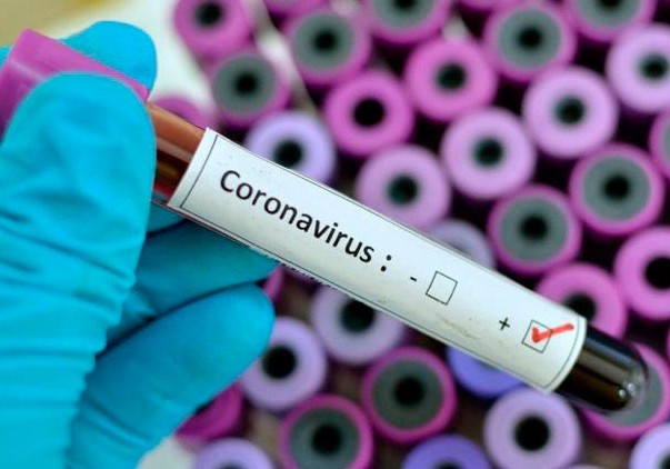 Koronavirusun ən çox yayıldığı ölkələr - SİYAHI