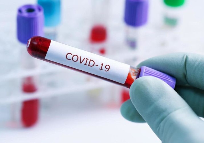 Azərbaycanda koronavirus aşkarlanmış 33 məhkum karantinə yerləşdirilib