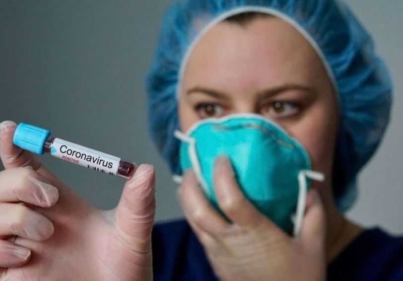 Azərbaycanda 65 yeni koronavirus infeksiyasına yoluxma faktı qeydə alınıb, 54 nəfər sağalıb