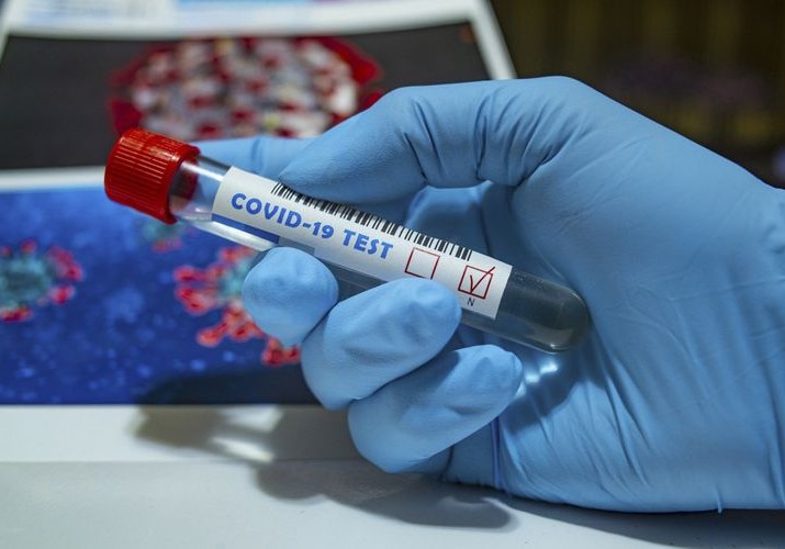 Azərbaycanda daha 149 nəfər koronavirusa yoluxub, 134 nəfər sağalıb, iki nəfər vəfat edib