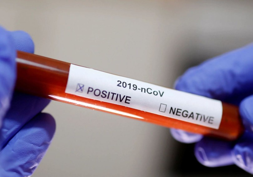İngiltərə Premyer Liqasında daha 4 nəfər koronavirusa yoluxub