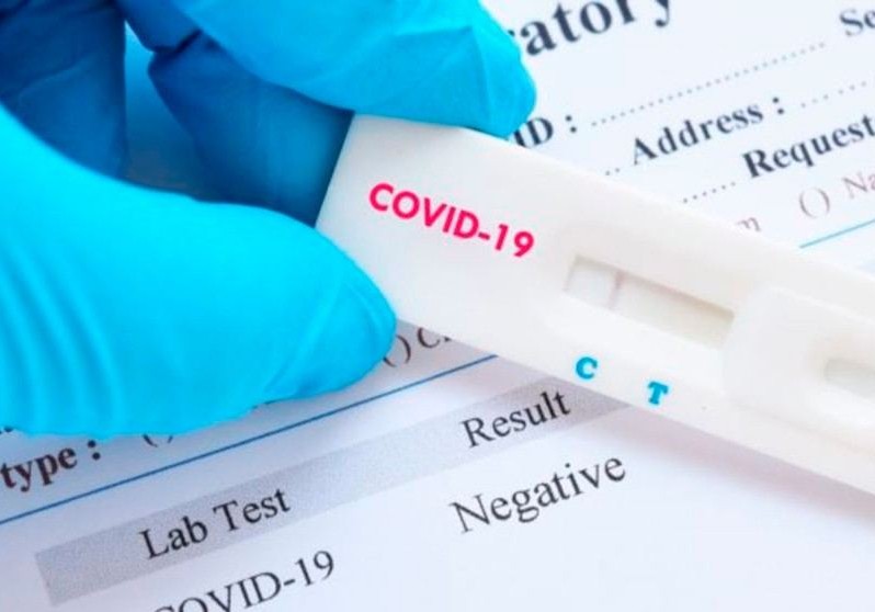 Koronavirus xəstələrindən götürülən testin həssaslığı 100 faiz deyil