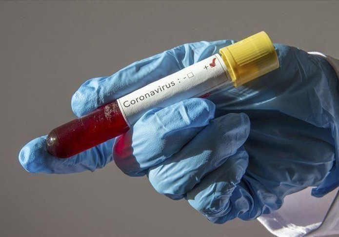 ÜST: Dünyada koronavirusa yoluxanların sayı 463 mindən çox artıb