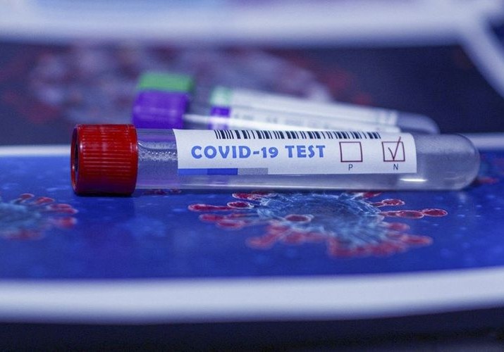TƏBİB Azərbaycanda koronavirus testlərinin bitməsi barədə məlumatlara aydınlıq gətirib