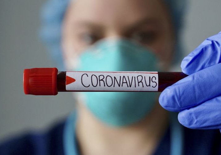 Ermənistanda son sutka ərzində 1277 nəfər koronavirusa yoluxub