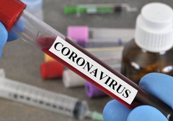 Azərbaycanda indiyədək 3 253 878 koronavirus testi aparılıb