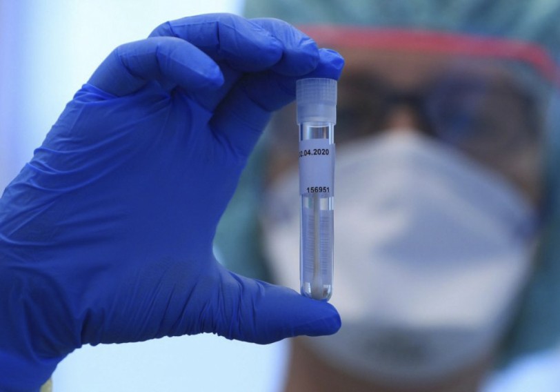 Azərbaycanda indiyədək 3 375 679 koronavirus testi aparılıb