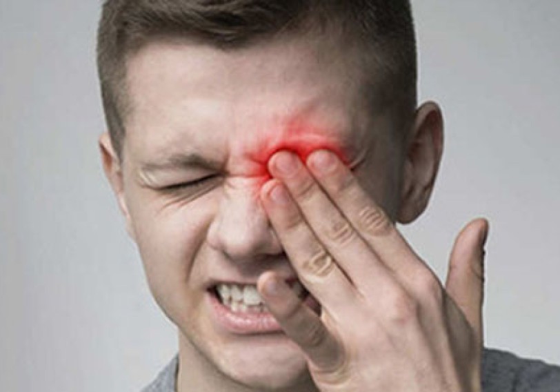 Sinirlərlə zəngin olan göz ağrılarına beyin mənşəli xəstəliklər də səbəb ola bilər