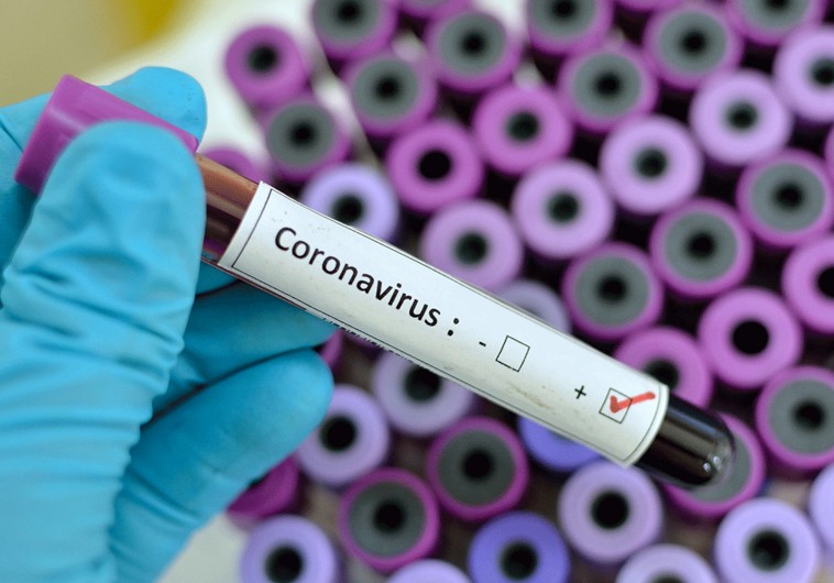 Azərbaycanda koronavirusa 595 yeni yoluxma qeydə alınıb, 12 nəfər vəfat edib