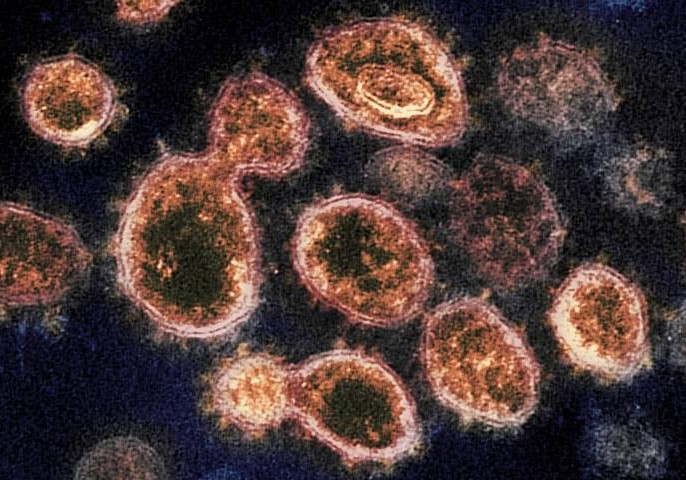 Potensial təhlükəli yeni koronavirus aşkar edilib